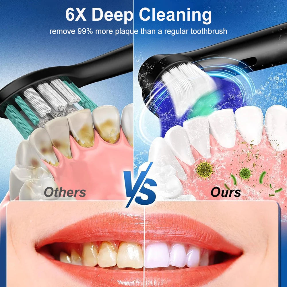 Rotary Electric Toothbrush with Soft Brush Heads - Smarsty