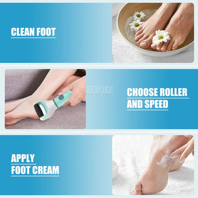 Electric Foot Grinder for Painless Dead Skin Removal - Smarsty