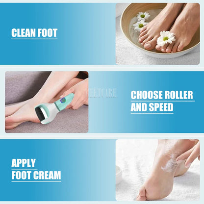 Electric Foot Grinder for Safe Painless Skin Removal - Smarsty