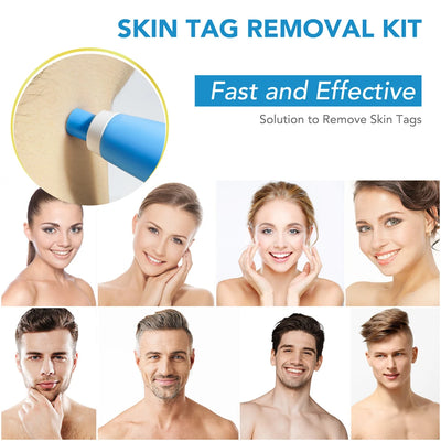 2 In 1 Painless Skin Tag Removal Kit for Face and Body - Smarsty