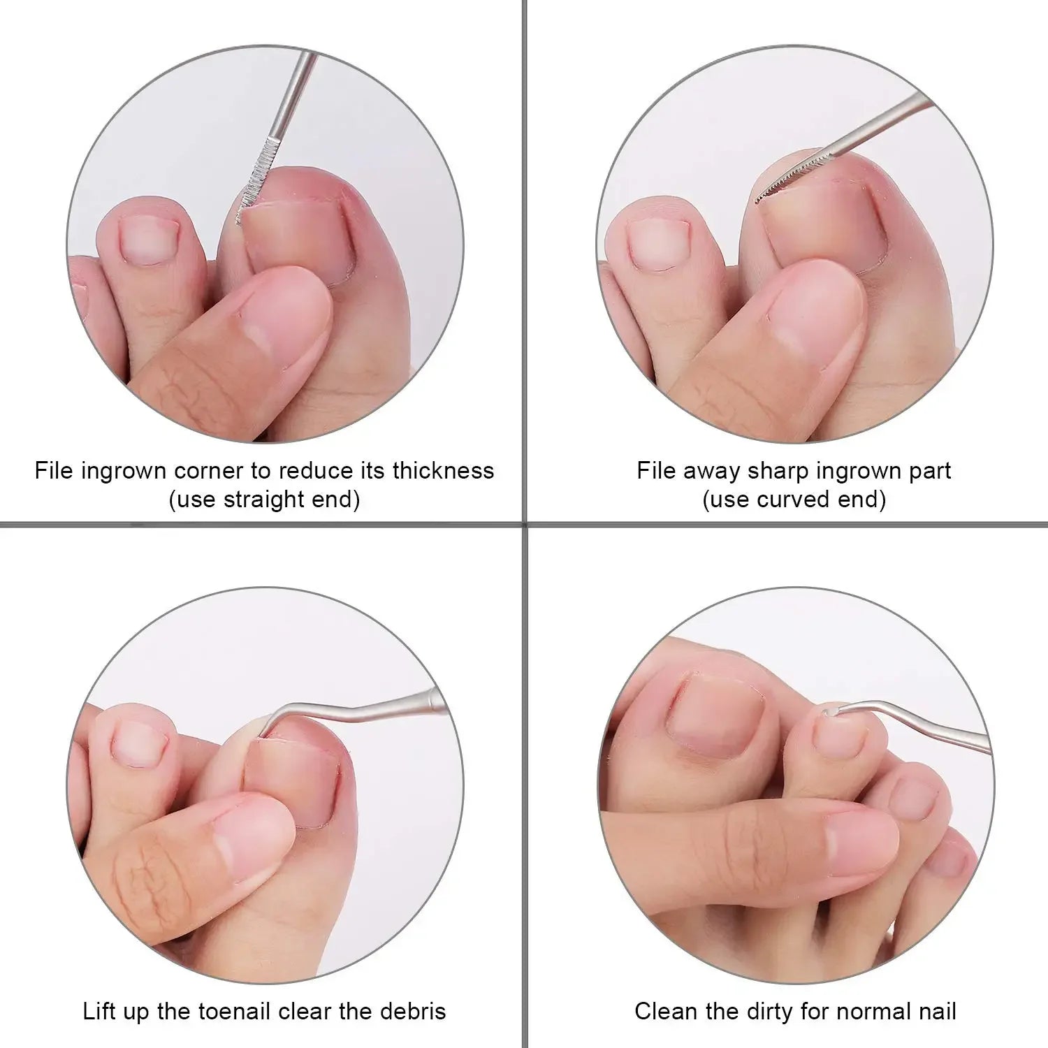 Professional Toe Nail Clipper Set for Ingrown Toenails - Smarsty