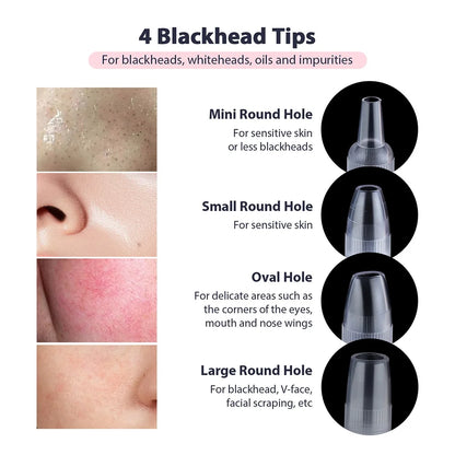 Professional Diamond Microdermabrasion Machine for Home Use - Smarsty