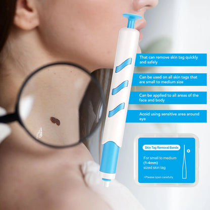3 In 1 Painless Skin Tag Removal Kit - Smarsty