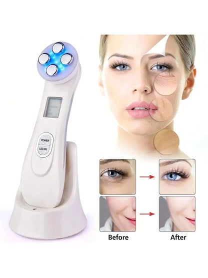 Professional Ultrasonic Face Exfoliator Skin Cleaner Tool - Smarsty