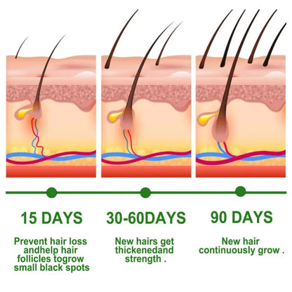 Rosemary Essential Oil for Moisturizing Healthy Hair - Smarsty