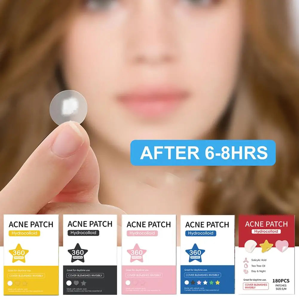 360 Pcs Colorful Hydrocolloid Acne Patches for Quick Healing - Smarsty