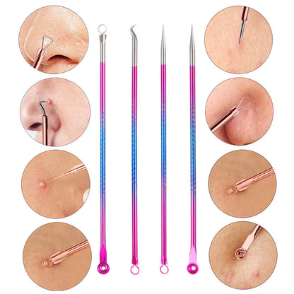 4PCS Acne Blackhead Remover Tool Set for Clear Skin - Smarsty