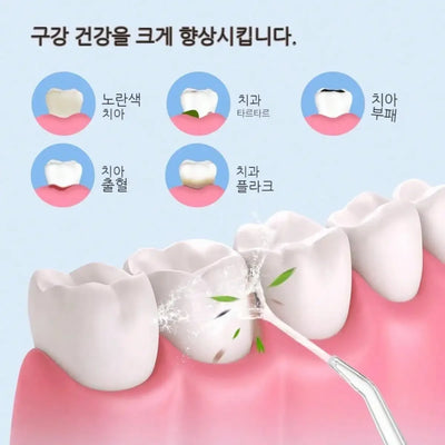 Electric Water Floss, Intelligent Chip, Precise Pressure Control, 360 Degree Rotating Nozzle, Tooth Cleaning Device - Smarsty
