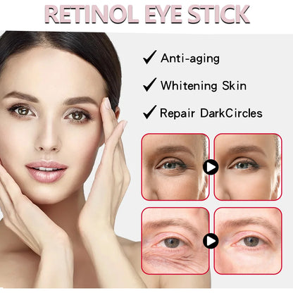 Retinol Eye Cream Stick for Dark Circles and Puffiness - Smarsty