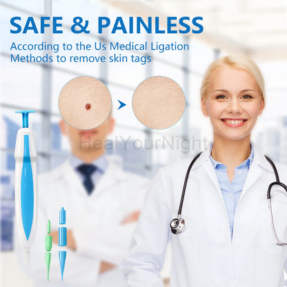 3 In 1 Painless Skin Tag Removal Kit - Smarsty