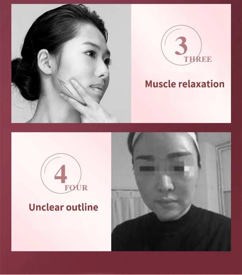 LED Facial Slimming Massager for V Face Lift - Smarsty
