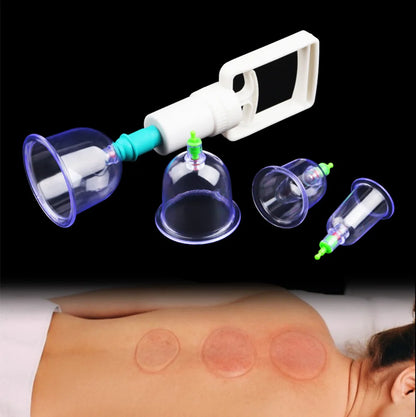 6Pcs Vacuum Cupping Set with Suction Cups for Body Massage - Smarsty