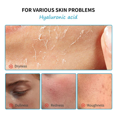5PCS Skincare Set Hydrate Brighten Firm Skin Exfoliating Acne Removal Shrink Pore Fix Sensitive Dullness Collagen Face Kit