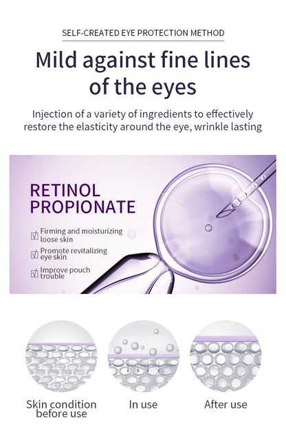 O'CHEAL Anti Aging Eye Cream Roller for Dark Circles - Smarsty