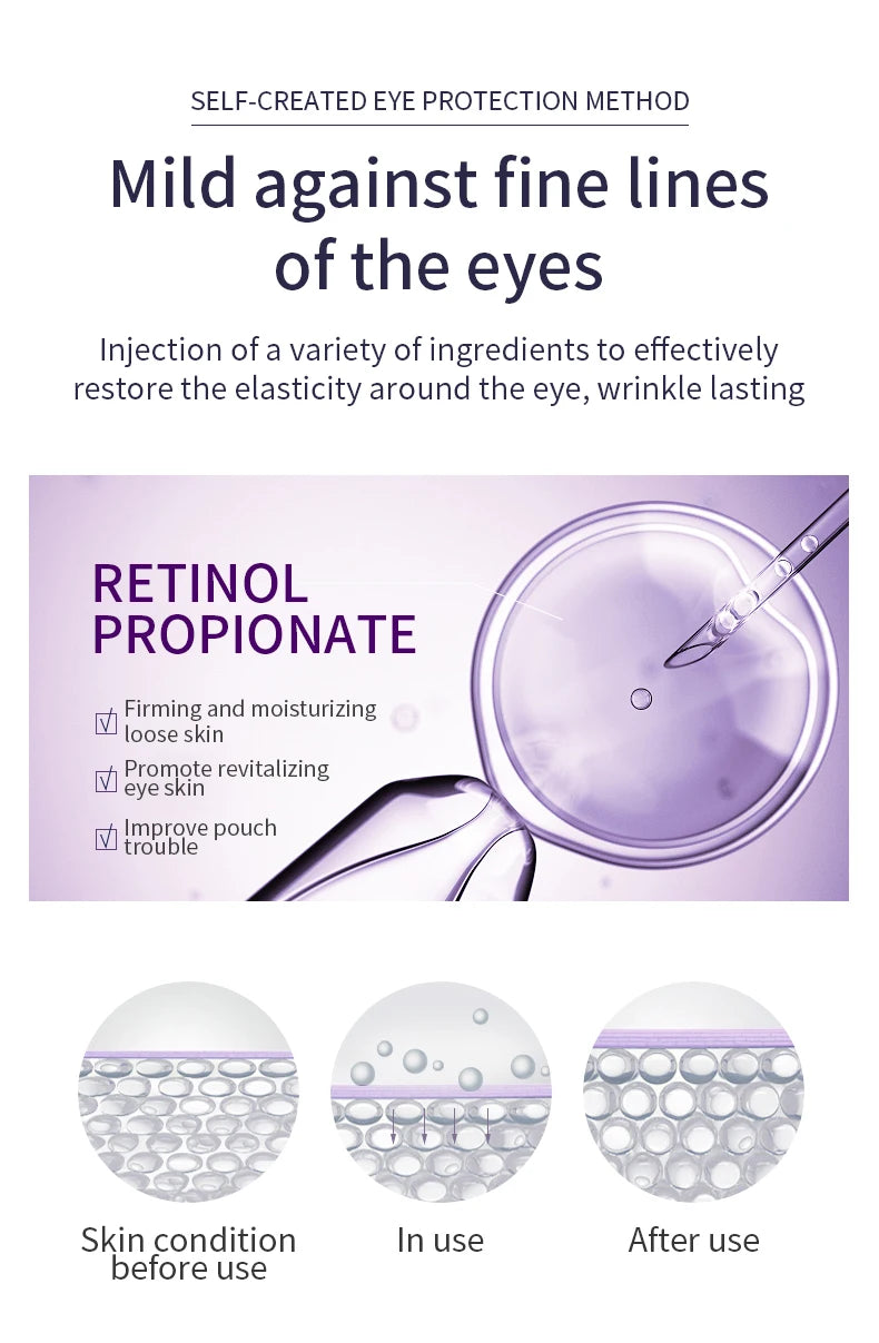 O'CHEAL Anti Aging Eye Cream Roller for Dark Circles - Smarsty