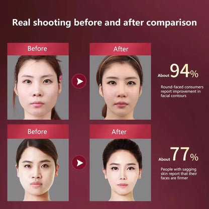 LED Facial Slimming Massager for V Face Lift - Smarsty