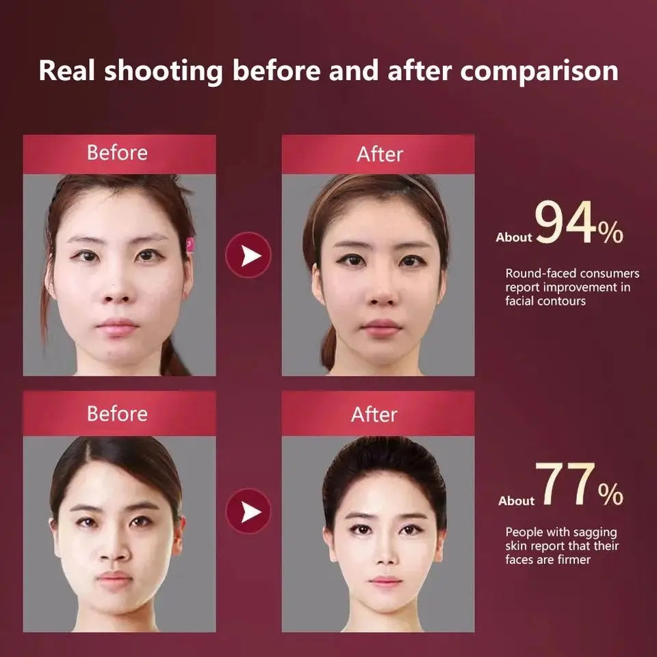 LED Facial Slimming Massager for V Face Lift - Smarsty