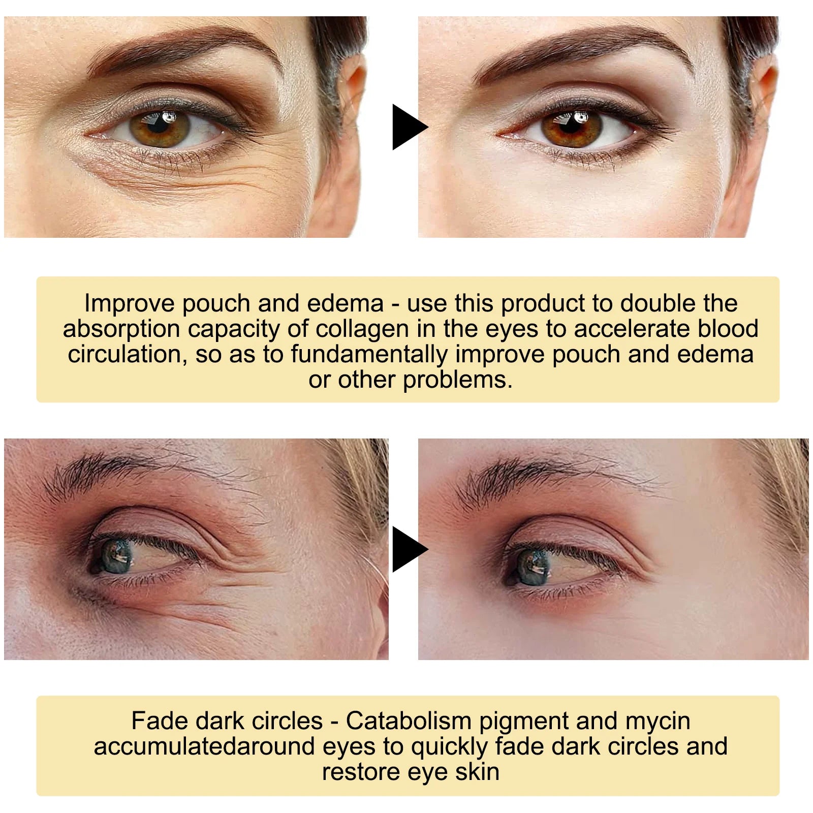 24K Gold Eye Masks for Dark Circles and Hydration - Smarsty