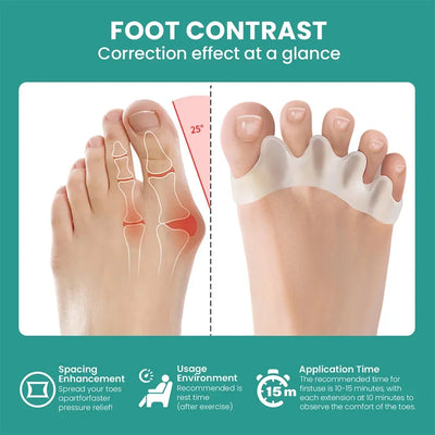 Silicone Toe Separators for Bunion Correction and Foot Comfort - Smarsty