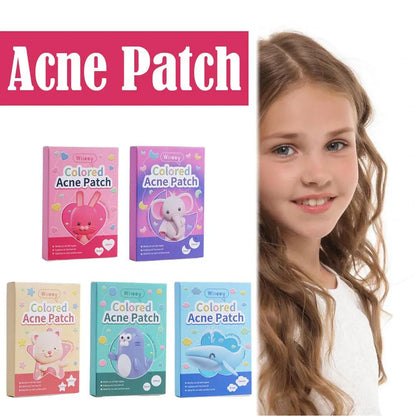 144PCS Colorful Acne Patches for Clear Skin - Smarsty