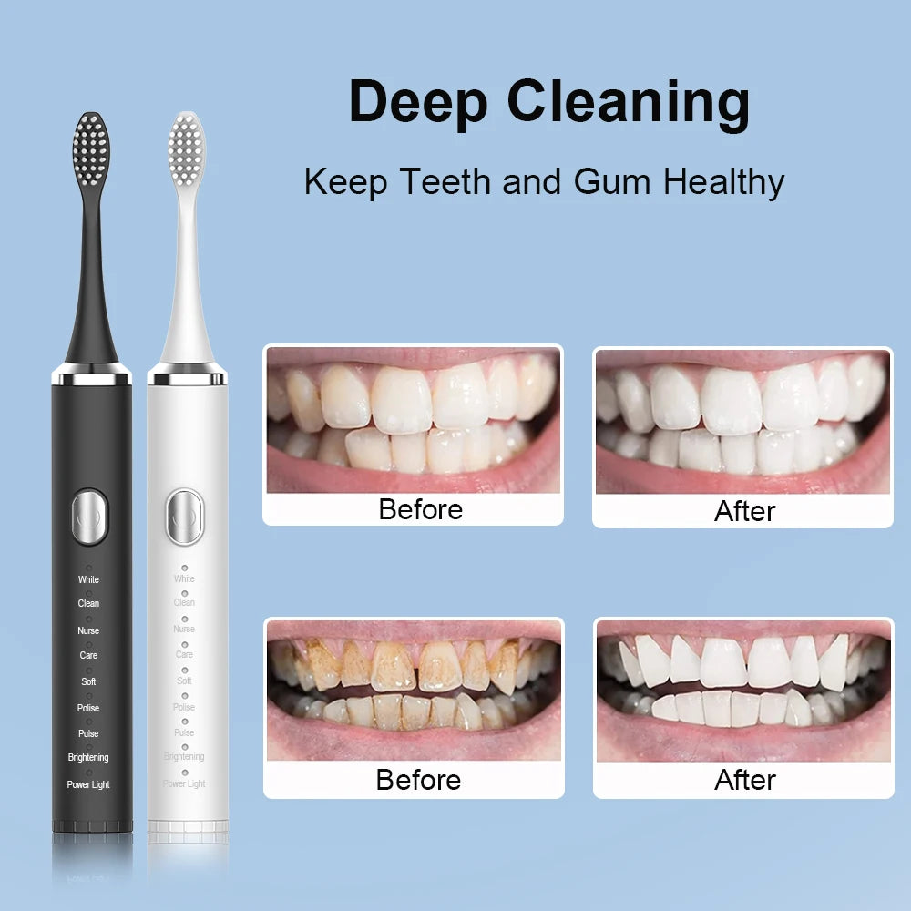 Electric Toothbrush With Sonic Vibration For Deep Cleaning - Smarsty