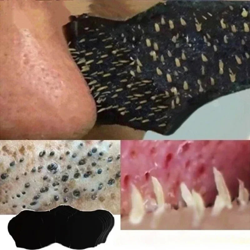 Unisex Blackhead Removal Nasal Strips for Clear Skin - Smarsty