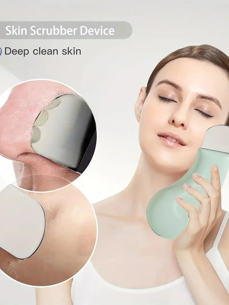 Blackhead and Whitehead Removal Tool for Clear Skin - Smarsty