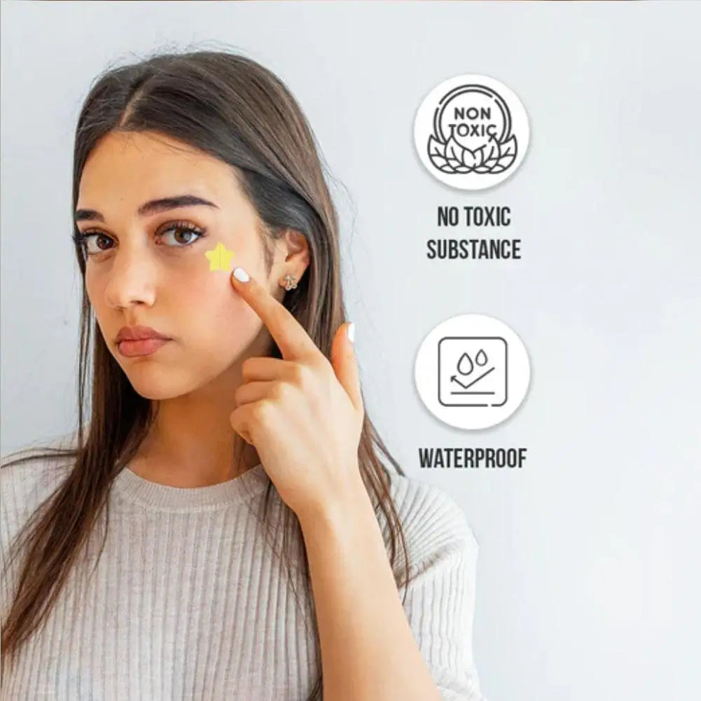 360 Pcs Colorful Hydrocolloid Acne Patches for Quick Healing - Smarsty