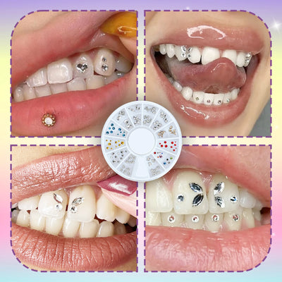 DIY Teeth Gems Kit With Glues And Light Teeth Anti-drop Clear Precious Stone Jewelry Decoration Glittering Tooth Jewelry Kit - Smarsty