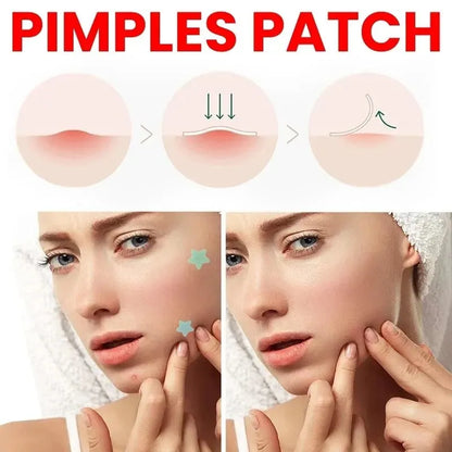 Effective Acne Repair Patch for Fading Blemishes - Smarsty