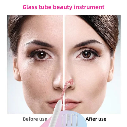 4 in 1 High Frequency Skin Care Wand for Acne - Smarsty