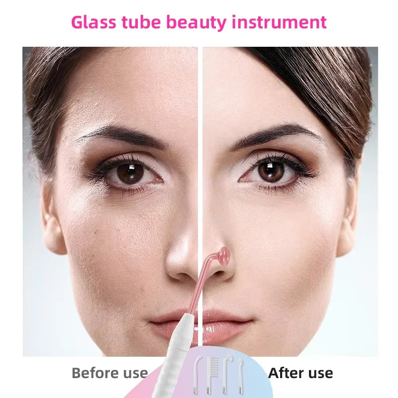 4 in 1 High Frequency Acne Treatment Wand - Smarsty