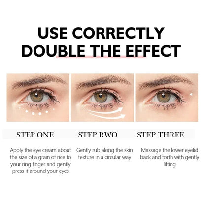 Nicotinamide Eye Cream for Dark Circles and Puffiness - Smarsty