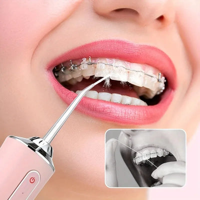 USB Portable Oral Irrigator Water Flosser Dental Water Jet Tools Pick Cleaning Teeth 200ML 4 Nozzles Mouth Oral Cleaning Agents - Smarsty