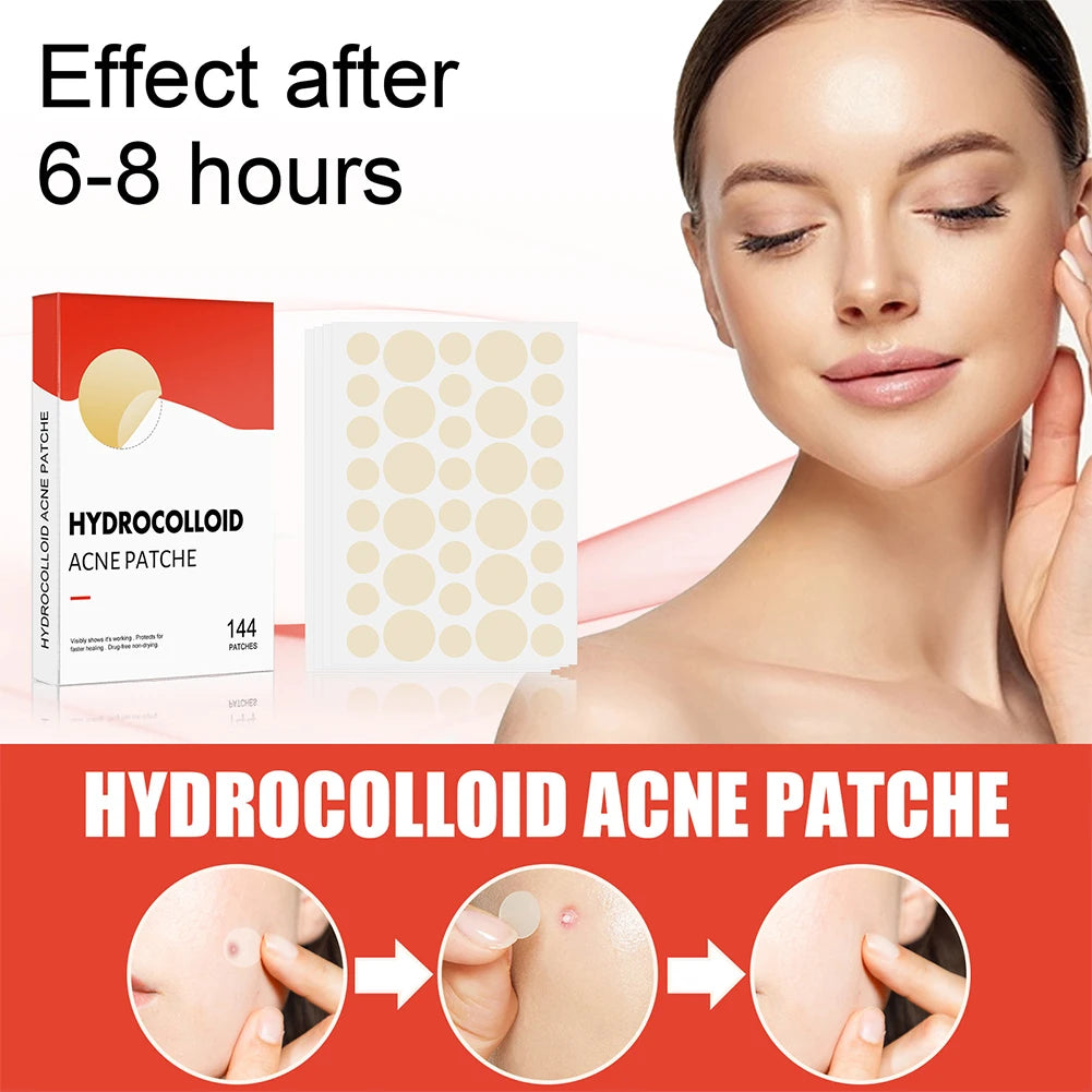 144 Piece Acne Pimple Patch Set for Clear Skin - Smarsty
