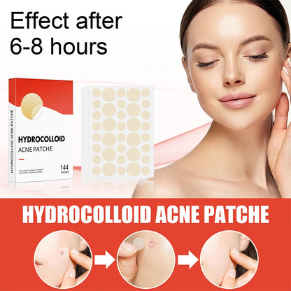 144 Piece Acne Pimple Patch Set for Clear Skin - Smarsty