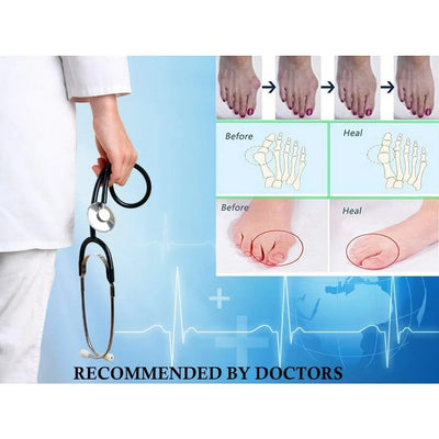 Soft Gel Bunion Corrector Toe Separator Spacers - Smarsty