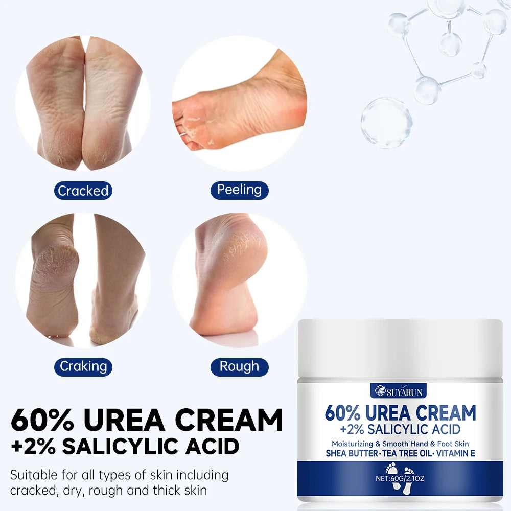 SUYARUN 60% Urea Foot Cream for Cracked Heels & Dry Skin - Intensive Moisturizing Treatment, Callus Remover, Diabetic Foot Care. - Smarsty