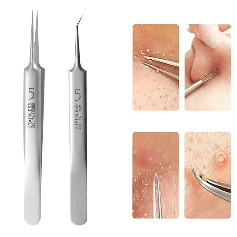 German Ultra Fine Blackhead Remover Tool for Clear Skin - Smarsty