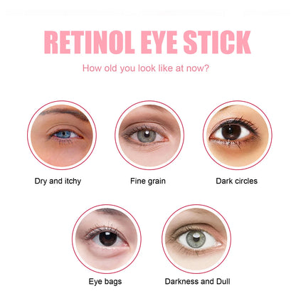Retinol Eye Cream Stick for Dark Circles and Puffiness - Smarsty