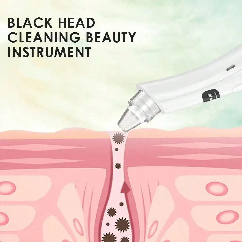 Rechargeable Face Cleansing Machine with Suction Modes - Smarsty