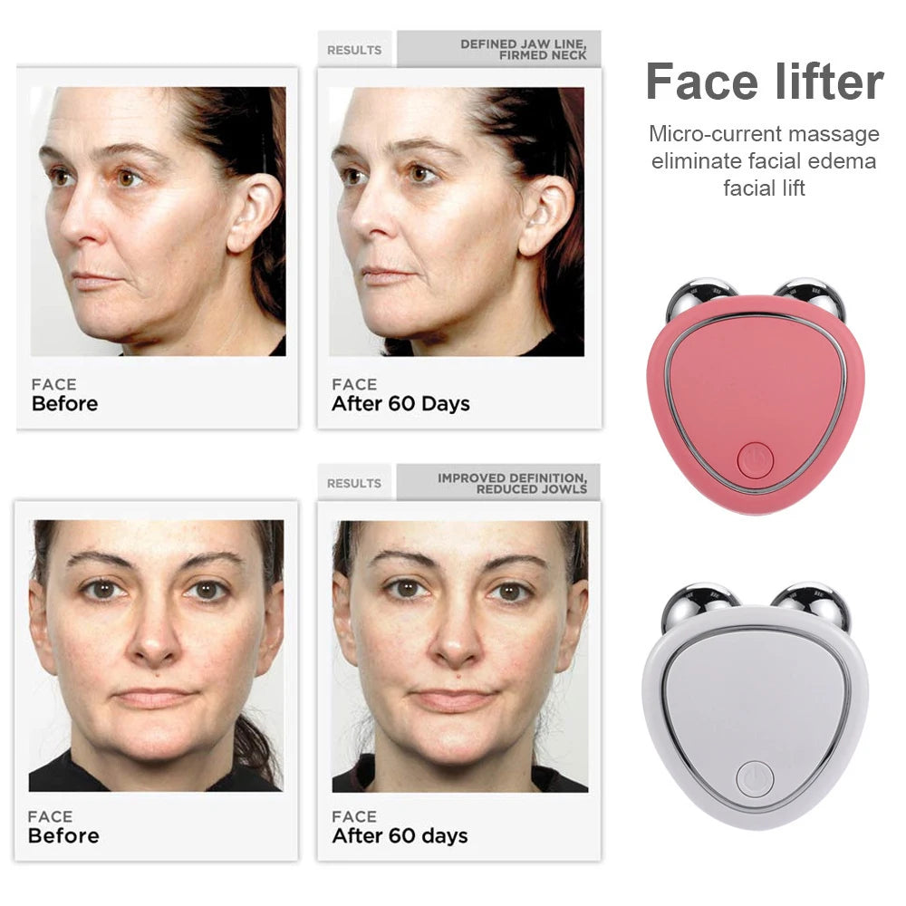 EMS Face Lifting Machine for Skin Tightening and Rejuvenation - Smarsty