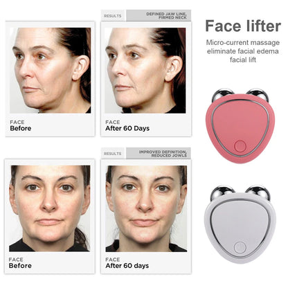 EMS Face Lifting Machine for Skin Tightening and Rejuvenation - Smarsty