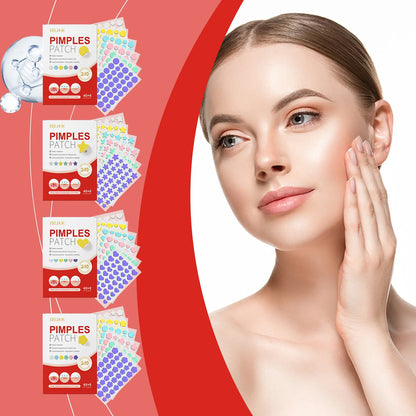 240pcs Star Acne Patches For Effective Spot Treatment - Smarsty