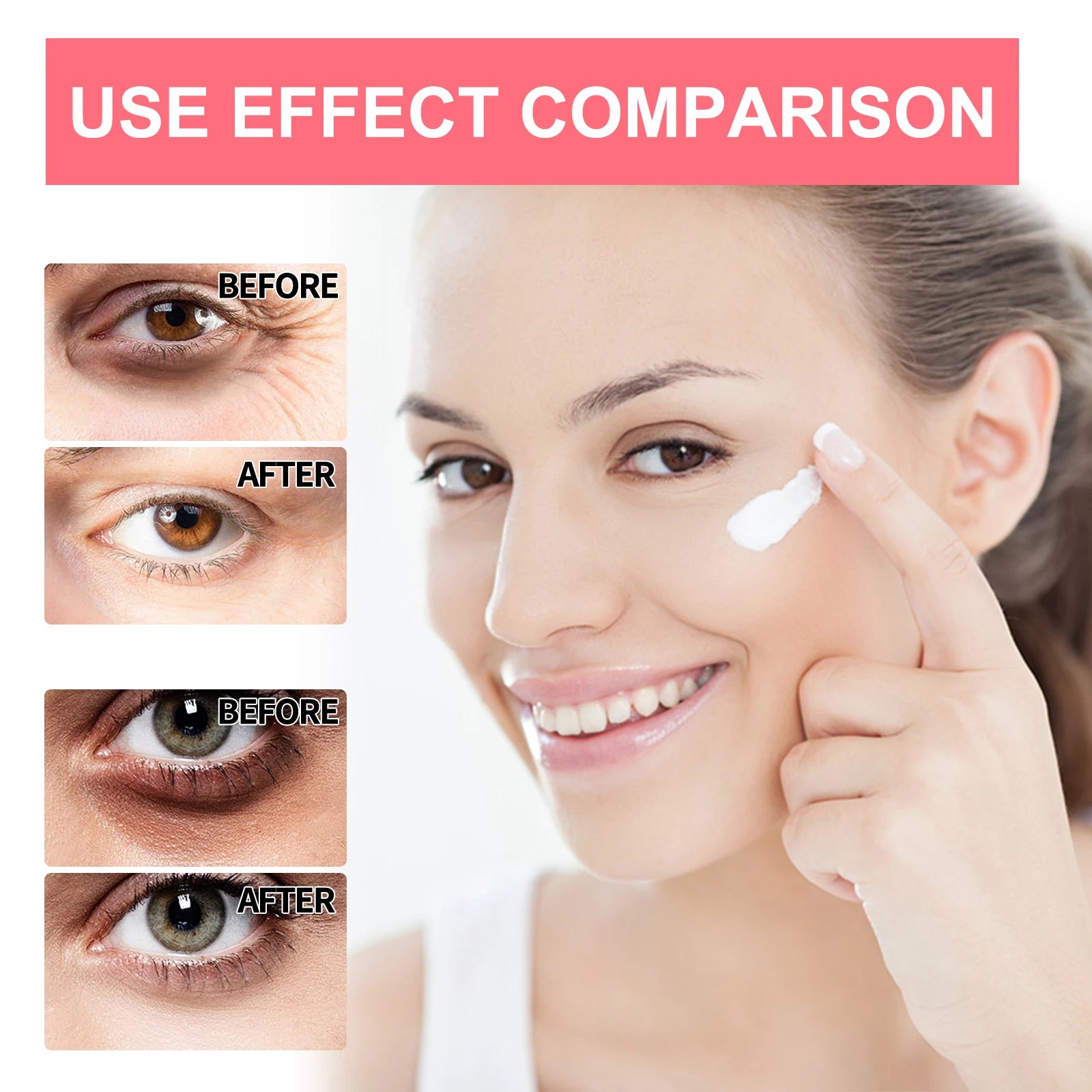 Retinol Eye Cream for Dark Circles and Wrinkles - Smarsty