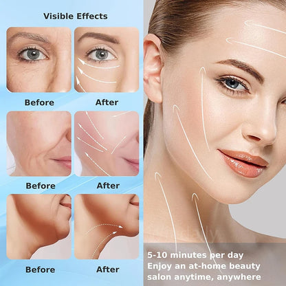 7 Colors Anti Wrinkle Facial Massager for Skin Tightening - Smarsty