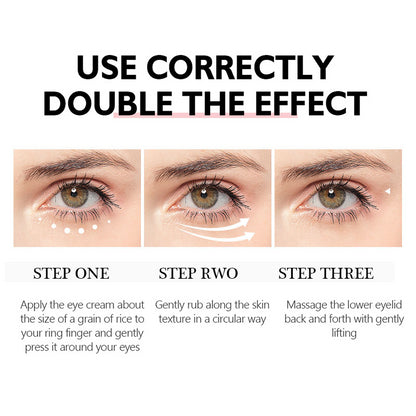 Nicotinamide Eye Cream for Dark Circles and Puffiness - Smarsty