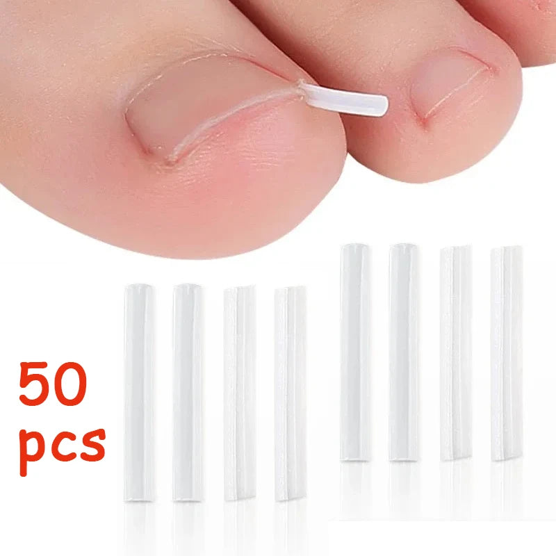 50Pcs Ingrown Toenail Correction Pads for Pain Relief - Smarsty