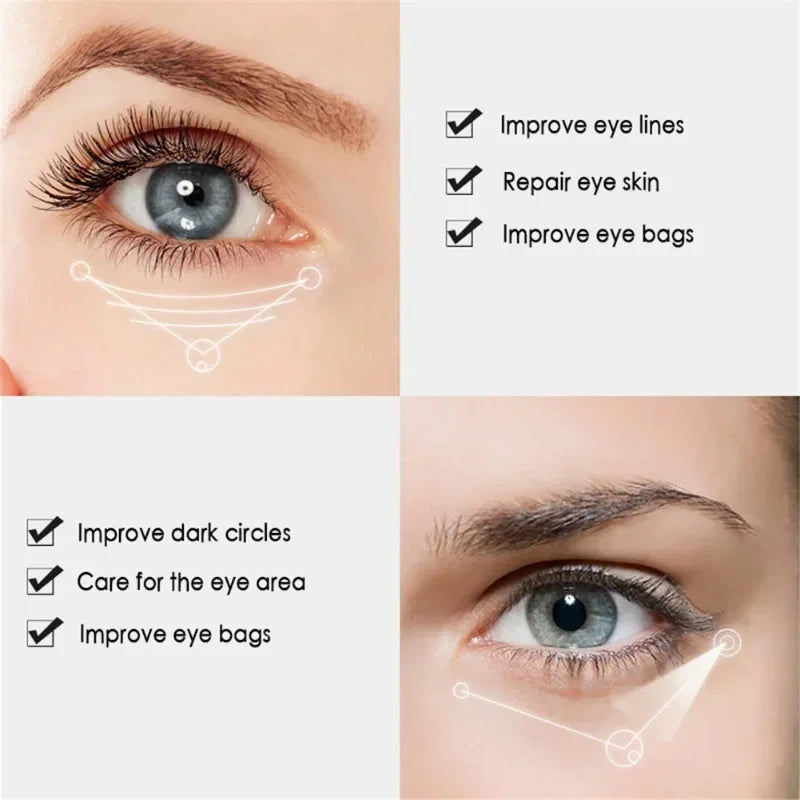 Nicotinamide Eye Cream for Dark Circles and Puffiness - Smarsty
