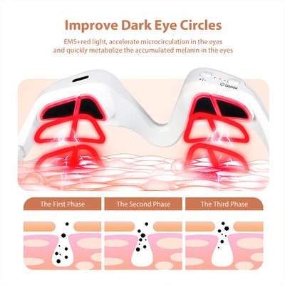 Electric Eye Massager for Dark Circles and Eye Bags - Smarsty